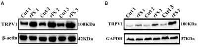 Western Blot: Vanilloid R1/TRPV1 Antibody [NB100-98886] - Transient receptor potential vanilloid type 1 (Vanilloid R1/TRPV1) protein expression pattern in cortical microglia after rFS. Western blot analysis of total protein (A) and membrane protein expression (B) of Vanilloid R1/TRPV1 in three samples from rFSs group's mice. Image collected and cropped by CiteAb from the following publication (www.frontiersin.org/articles/10.3389/fncel.2019.00442/full) licensed under a CC-BY license.