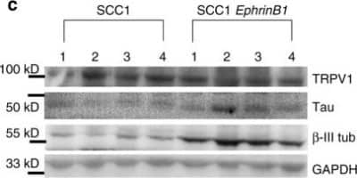 Western Blot: Vanilloid R1/TRPV1 Antibody [NB100-98897] - HPV status and EphrinB1 contribute to neurite outgrowth. Western blot analysis of whole tumor lysates from mice bearing SCC1 or SCC1 EphrinB1 tumors. Western blots repeated at least n = 4 times with technical replicates. Western blots have been cropped for clarity and conciseness. Image collected and cropped by CiteAb from the following publication (www.nature.com/articles/s41467-018-06640-0) licensed under a CC-BY license.