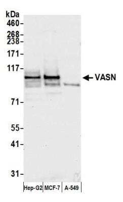 Vasorin/SLIT-like 2 Antibody [NBP2-76371] - Samples: Whole cell lysate (50 ug) from Hep-G2, MCF-7, and A-549 cells prepared using NETN lysis buffer. Antibody: Affinity purified rabbit anti-VASN antibody NBP2-76371 used for WB at 1:1000. Detection: Chemiluminescence with an exposure time of 10 seconds.