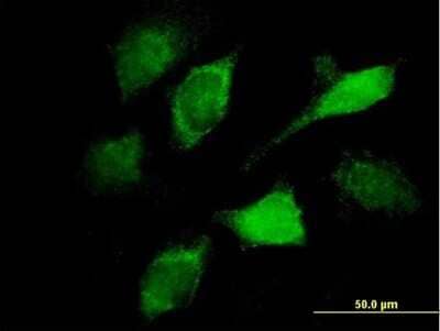Immunocytochemistry/Immunofluorescence: Vav-1 Antibody (3A11) [H00007409-M04] - Analysis of monoclonal antibody to VAV1 on HeLa cell. Antibody concentration 10 ug/ml