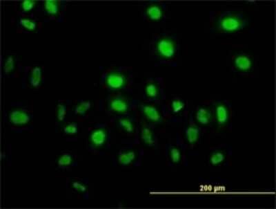 Immunocytochemistry/Immunofluorescence: Vav-1 Antibody (9C1) [H00007409-M01] - Analysis of monoclonal antibody to VAV1 on HeLa cell. Antibody concentration 10 ug/ml.