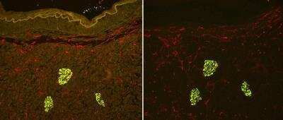 Immunohistochemistry: Vector(R) TrueVIEW(TM) Autofluorescence Quenching Kit [SP-8400-NB] - Pancreas (FFPE), antigen retrieved with Antigen Unmasking Solution, stained with Guinea Pig x Insulin (green) and Mouse x END (red), followed by FL-Goat x Guinea Pig IgG + Dylight(R) 594-Horse x Mouse IgG. Mounted in VECTASHIELD(R) HardSet(TM) Mounting Medium with DAPI.No TrueVIEW(TM) Quencher => 20x objective, red channel exposed 600ms, green channel 600ms.With TrueVIEW(TM) Quencher => 20x objective, red channel exposed 600ms, green channel exposed 600ms.