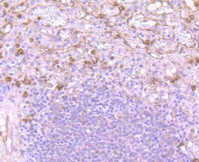 Immunohistochemistry-Paraffin: Versican Antibody (JB42-32) [NBP2-75706] - Analysis of paraffin-embedded human spleen tissue using anti-Versican antibody. Counter stained with hematoxylin.