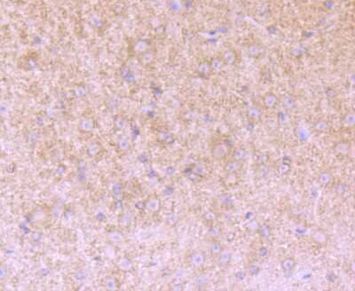 Immunohistochemistry-Paraffin: Versican Antibody (JB42-32) [NBP2-75706] - Analysis of paraffin-embedded mouse brain tissue using anti-Versican antibody. Counter stained with hematoxylin.