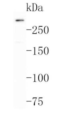 Western Blot: Versican Antibody (JB42-32) [NBP2-75706] - Analysis of Versican on Hela cell lysates. Proteins were transferred to a PVDF membrane and blocked with 5% BSA in PBS for 1 hour at room temperature. The primary antibody (1/500) was used in 5% BSA at room temperature for 2 hours. Goat Anti-Rabbit IgG - HRP Secondary Antibody at 1:200,000 dilution was used for 1 hour at room temperature.