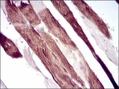 Immunohistochemistry-Paraffin: Villin 1 Antibody (5E3B2) [NBP2-52584] - Analysis of paraffin-embedded muscle tissues using VIL1 mouse mAb with DAB staining.