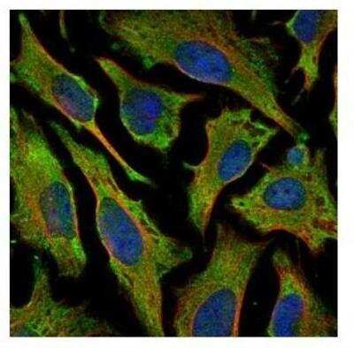 Immunocytochemistry/Immunofluorescence: Villin 1 Antibody [NBP1-32841] - Analysis of methanol-fixed HeLa, using Villin antibody (Green) at 1:500 dilution. Alpha-tubulin filaments were labeled with an alpha Tubulin antibody (Red) at 1:2000.