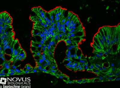 Immunocytochemistry/Immunofluorescence: Villin 1 Antibody [NBP1-32841] - Villin 1 and Cadherin-17 were detected in immersion fixed, paraffin-embedded sections of MimEX adult stem cell-derived ascending colon tissue with Mouse Anti-Human Cadherin-17 Monoclonal Antibody (Catalog # MAB1032) at 1.25 ug/mL and Rabbit Anti-Human/Mouse/Rat/Bovine Villin 1 Antibody (Catalog # NBP1-32841) at 0.62 ug/mL overnight at 4 C.  Tissue was then stained using the NorthernLights 493-conjugated Anti-Mouse IgG Secondary Antibody (green; Catalog # NL009) and NorthernLights 557-conjugated Anti-Rabbit IgG Secondary Antibody (red; Catalog # NL004) and counterstained with DAPI (blue).  Cadherin-17 staining was detected in cellular membranes throughout the epithelial layer while Villin 1 staining was localized specifically to the apical surface of the polarized epithelial layer.