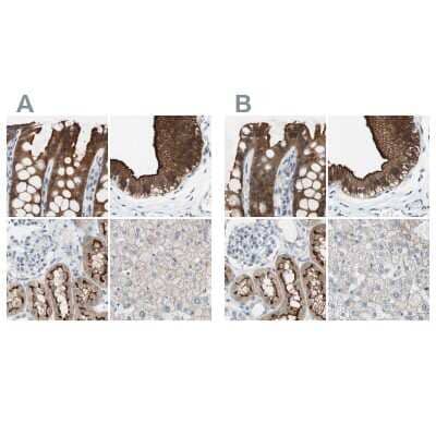 <b>Independent Antibodies Validation. </b>Immunohistochemistry-Paraffin: Villin 1 Antibody [NBP1-85335] - Staining of human colon, gallbladder, kidney and liver using Anti-VIL1 antibody NBP1-85335 (A) shows similar protein distribution across tissues to independent antibody NBP1-85336 (B).