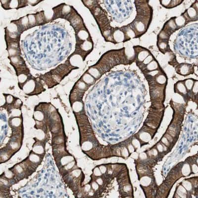 Immunohistochemistry-Paraffin: Villin 1 Antibody [NBP1-85336] - Staining of human small intestine shows strong positivity in apical membrane in glandular cells.