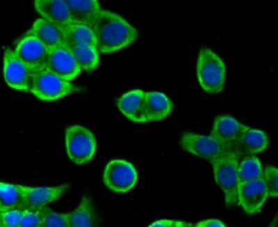 Immunocytochemistry/Immunofluorescence: Villin 1 Antibody (JU34-75) [NBP2-75707] - Staining Villin1 in LOVO cells (green). The nuclear counter stain is DAPI (blue). Cells were fixed in paraformaldehyde, permeabilised with 0.25% Triton X-100/PBS.