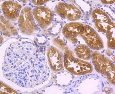 Immunohistochemistry-Paraffin: Villin 1 Antibody (JU34-75) [NBP2-75707] - Analysis of paraffin-embedded human kidney tissue using anti-Villin1 antibody. Counter stained with hematoxylin.