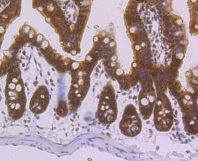 Immunohistochemistry-Paraffin: Villin 1 Antibody (JU34-75) [NBP2-75707] - Analysis of paraffin-embedded mouse colon tissue using anti-Villin1 antibody. Counter stained with hematoxylin.