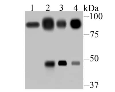 Western Blot: Villin 1 Antibody (JU34-75) [NBP2-75707] - Analysis of Villin1 on different tissue lysates using anti-Villin1 antibody at 1:500 dilution. Positive control:Lane 1: Mouse colon. Lane 2: Human small intestine. Lane 3: Human colon. Lane 4: Rat kidney.