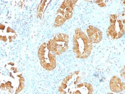 Immunohistochemistry-Paraffin: Villin 1 Antibody (VIL1/1314) - Azide and BSA Free [NBP2-50081] - Formalin-fixed, paraffin-embedded human Rectum stained with Villin Monoclonal Antibody (VIL1/1314).