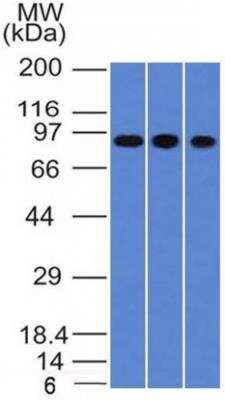 Western Blot: Villin 1 Antibody (VIL1/1314) - Azide and BSA Free [NBP2-50081] - Western Blot of A549, HepG2 & HCT116 cell lysates with Villin Monoclonal Antibody (VIL1/1314).