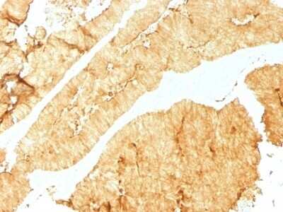Immunohistochemistry-Paraffin: Villin 1 Antibody (VIL1/1325) [NBP2-54515] - Formalin-fixed, paraffin-embedded human Colon stained with Villin Monoclonal Antibody (VIL1/1325).