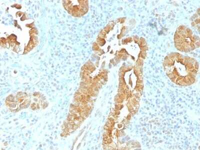 Immunohistochemistry-Paraffin: Villin 1 Antibody (VIL1/1325) [NBP2-54515] - Formalin-fixed, paraffin-embedded human Rectum stained with Villin Monoclonal Antibody (VIL1/1325).