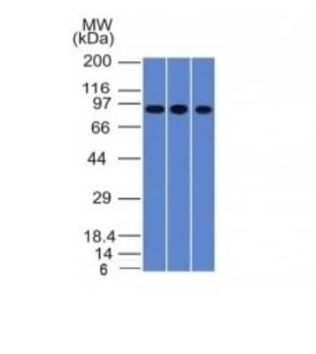 Western Blot: Villin 1 Antibody (VIL1/1325) [NBP2-53201] - Western Blot of A549, HepG2 & HCT116 Cell Lysates with Villin Monoclonal Antibody (VIL1/1325).