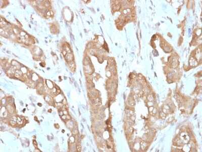 Immunohistochemistry-Paraffin: Villin 1 Antibody (VIL1/2310R) - Azide and BSA Free [NBP3-08929] - Formalin-fixed, paraffin-embedded human Small Intestine stained with Villin 1 Rabbit Recombinant Monoclonal Antibody (VIL1/2310R).