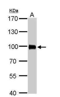 Western Blot: Villin 1 Antibody [NBP1-32841] - A. 50 ug rat kidney lysate/extract 7.5 % SDS-PAGE Villin antibody dilution: 1:2000