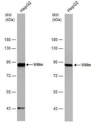 <b>Independent Antibodies Validation. </b>Western Blot: Villin 1 Antibody [NBP1-32841] - Whole cell extract (30 ug) was separated by 7.5% SDS-PAGE, and the membranes were blotted with Villin antibody. HRP-conjugated anti-rabbit IgG antibody was used to detect the primary antibody.