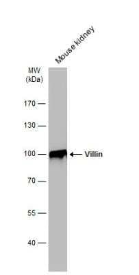 Western Blot: Villin 1 Antibody [NBP1-32841] - Mouse tissue extract (50 ug) was separated by 7.5% SDS-PAGE, and the membrane was blotted with Villin antibody diluted at 1:1000. The HRP-conjugated anti-rabbit IgG antibody (NBP2-19301) was used to detect the primary antibody.
