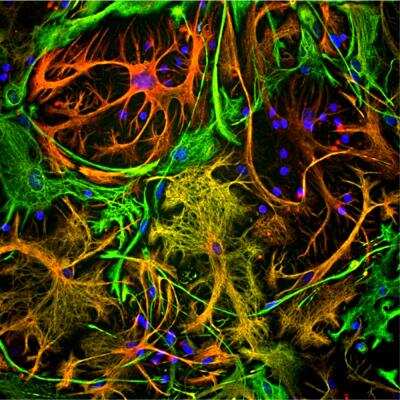 <b>Genetic Strategies Validation. </b>Immunocytochemistry/Immunofluorescence: Vimentin Antibody (2A52) [NBP1-92688] - Immunocytochemistry/Immunofluorescence:  [NBP1-92688] - View of mixed neuron/glial cultures stained with NBP1-92687 (green) and the GFAP rabbit polyclonal (NB300-141, red). Vimentin is expressed alone in fibroblastic and endothelial cells, which are the flattened cells in the middle of the imate which appear green. Astrocytes may express primarily GFAP, or GFAP and Vimentin, and so appear red (GFAP only) or golden yellow (GFAP and Vimentin). In cells which express both GFAP and Vimentin, the two proteins assemble to produce heteropolymer filaments.