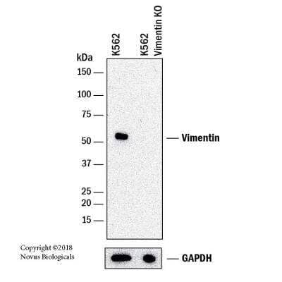 Knockout Validated: Vimentin Antibody (2A52) [NBP1-92688] - Western blot shows lysates of K562 human Chronic Myelogenous Leukemia parental cell line and Vimentin knockout (KO) K562 cell line. PVDF membrane was probed with 1:10,000 of Mouse Anti-Human Vimentin Monoclonal Antibody (Catalog # NBP1-92688) followed by HRP-conjugated Anti-Mouse IgG Secondary Antibody (Catalog #HAF018). Specific band was detected for Vimentin at approximately 55 kDa (as indicated) in the parental K562 cell line, but is not detectable in the knockout K562 cell line. This experiment was conducted under reducing conditions.