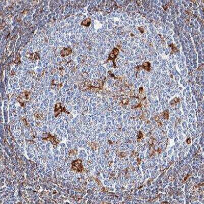 Immunohistochemistry-Paraffin: Vimentin Antibody (979542) [Unconjugated] [MAB21053] - Vimentin was detected in immersion fixed paraffin-embedded sections of human lymph node tissue using Mouse Anti-Human Vimentin Monoclonal Antibody (Catalog # MAB21053) at 5 ug/mL for 1 hour at room temperature followed by incubation with the Anti-Mouse IgG VisUCyte HRP Polymer Antibody (Catalog # VC001). Before incubation with the primary antibody, tissue was subjected to heat-induced epitope retrieval using Antigen Retrieval Reagent-Basic (Catalog # CTS013). Tissue was stained using DAB (brown) and counterstained with hematoxylin (blue). Specific staining was localized to cytoplasm in lymphocytes in germinal centers. 