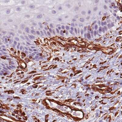 Immunohistochemistry-Paraffin: Vimentin Antibody (CL0157) [NBP2-52867] - Staining of human skin shows distinct positivity in fibroblasts.