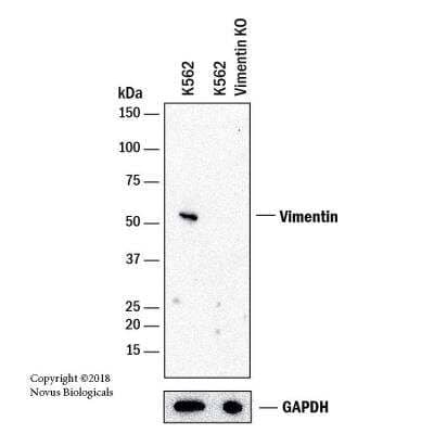 Knockout Validated: Vimentin Antibody (CL0157) [NBP2-52867] - Western blot shows lysates of K562 human Chronic Myelogenous Leukemia parental cell line and Vimentin knockout (KO) K562 cell line. PVDF membrane was probed with 0.7 ug/mL of Mouse Anti-Human Vimentin Monoclonal Antibody (Catalog # NBP2-52867) followed by HRP-conjugated Anti-Mouse IgG Secondary Antibody (Catalog #HAF018). Specific band was detected for Vimentin at approximately 55 kDa (as indicated) in the parental K562 cell line, but is not detectable in the knockout K562 cell line. This experiment was conducted under reducing conditions.