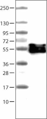 Western Blot: Vimentin Antibody (CL0157) [NBP2-52867] - Lane 1: Marker [kDa]  Lane 2: Human tonsil tissue lysate