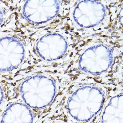 Immunohistochemistry-Paraffin: Vimentin Antibody [NBP3-03221] - Immunohistochemistry of paraffin-embedded human colon using [KO Validated] Vimentin Rabbit pAb (NBP3-03221) at dilution of 1:100 (40x lens). Perform high pressure antigen retrieval with 10 mM citrate buffer pH 6.0 before commencing with IHC staining protocol.