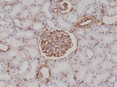 Immunohistochemistry-Paraffin: Vimentin Antibody (RM289) [NBP2-61592] - Immunohistochemical staining of formalin fixed and paraffin embedded human kidney tissue sections using NBP2-61592.