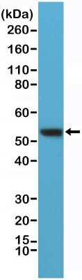Western Blot: Vimentin Antibody (RM289) [NBP2-61592] - Western Blot of HeLa lysates using NBP2-61592.