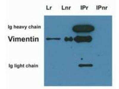 Immunoprecipitation: Vimentin Antibody (VI-10) [NB500-563] - Immunoprecipitation of vimentin from HeLa cell lysate by antibody VI-10 and its detection by antibody VI-01. IgM heavy chain (76-92 kDa) and IgM light chain (25-30 kDa) indicated. MW of vimentin is 57 kDa.