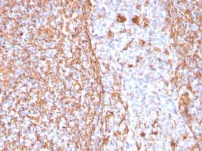 Immunohistochemistry-Paraffin: Vimentin Antibody (VIM/1937R) - Azide and BSA Free [NBP3-08936] - Formalin-fixed, paraffin-embedded human tonsil stained with Vimentin Rabbit Recombinant Monoclonal Antibody (VIM/1937R).