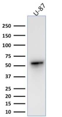 Western Blot: Vimentin Antibody (VIM/1937R) - Azide and BSA Free [NBP3-08936] - Western Blot Analysis of human U-87 cell lysate using Vimentin Rabbit Recombinant Monoclonal Antibody (VIM/1937R).