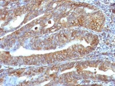 Immunohistochemistry-Paraffin: Vimentin Antibody (VM1170) - IHC-Prediluted [NBP2-48191] - Human Uterus stained with Vimentin Monoclonal Antibody (VM1170).