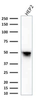 Western Blot: Vimentin Antibody (VM1170) [NBP2-44833] - Western Blot Analysis of HEP2 cell lysate using Vimentin Antibody (VM1170).