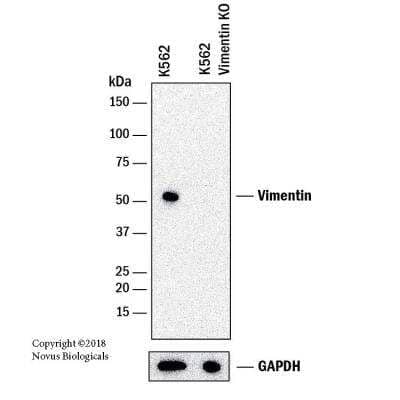 Knockout Validated: Vimentin Antibody (VM452) - Azide and BSA Free [NBP2-33060] - Western blot shows lysates of K562 human Chronic Myelogenous Leukemia parental cell line and Vimentin knockout (KO) K562 cell line. PVDF membrane was probed with 0.7 ug/mL of Mouse Anti-Human Vimentin Monoclonal Antibody (Catalog # NBP2-33060) followed by HRP-conjugated Anti-Mouse IgG Secondary Antibody (Catalog #HAF018). Specific band was detected for Vimentin at approximately 55 kDa (as indicated) in the parental K562 cell line, but is not detectable in the knockout K562 cell line. This experiment was conducted under reducing conditions.