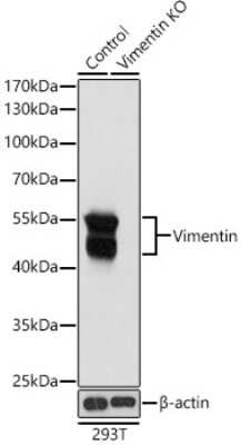 Western Blot: Vimentin Antibody [NBP3-03221] - Western blot analysis of extracts from normal (control) and Vimentin knockout (KO) 293T cells, using Vimentin antibody (NBP3-03221) at 1:1000 dilution. Secondary antibody: HRP Goat Anti-Rabbit IgG (H+L) at 1:10000 dilution. Lysates/proteins: 25ug per lane. Blocking buffer: 3% nonfat dry milk in TBST. Detection: ECL Basic Kit. Exposure time: 5s.