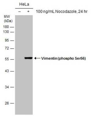 Western Blot: Vimentin [p Ser56] Antibody (GT11512) [NBP3-13578] - Untreated (-) and treated (+) HeLa whole cell extracts (30 ug) were separated by 10% SDS-PAGE, and the membrane was blotted with Vimentin (phospho Ser56) antibody [GT11512] (NBP3-13578) diluted at 1:3000.