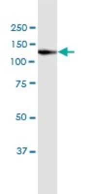 Western Blot: Vinculin Antibody (3F8-1D4) [H00007414-M02] - Vinculin monoclonal antibody, clone 3F8-1D4. Western Blot analysis of VCL expression in HeLa.