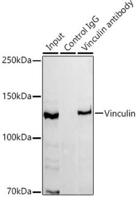 Immunoprecipitation: Vinculin Antibody (3J7P3) [NBP3-16145] - Immunoprecipitation analysis of 300ug extracts of HeLa cells using 3ug Vinculin antibody (NBP3-16145). Western blot was performed from the immunoprecipitate using Vinculin antibody (NBP3-16145) at a dilition of 1:1000.