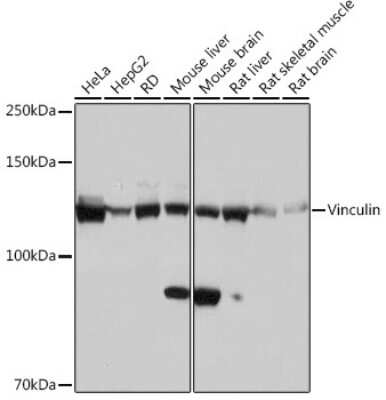 Western Blot: Vinculin Antibody (3J7P3) [NBP3-16145] - Western blot analysis of extracts of various cell lines, using Vinculin Rabbit mAb (NBP3-16145) at 1:1000 dilution. Secondary antibody: HRP Goat Anti-Rabbit IgG (H+L) at 1:10000 dilution. Lysates/proteins: 25ug per lane. Blocking buffer: 3% nonfat dry milk in TBST. Detection: ECL Basic Kit. Exposure time: 1s.