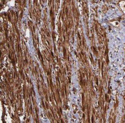 Immunohistochemistry-Paraffin: Vinculin Antibody [NBP1-87495] - Staining of human smooth muscle shows strong cytoplasmic positivity in smooth muscle cells.