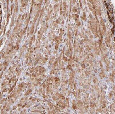 Immunohistochemistry-Paraffin: Vinculin Antibody [NBP1-87495] - Stainig of human prostate shows moderate cytoplasmic positivity in smooth muscle cells.