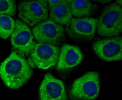 Immunocytochemistry/Immunofluorescence: Vinculin Antibody (JM42-43) [NBP2-75708] - Staining Vinculin in A431 cells (green). The nuclear counter stain is DAPI (blue). Cells were fixed in paraformaldehyde, permeabilised with 0.25% Triton X100/PBS.